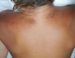 Female Upper Back or Lower Back