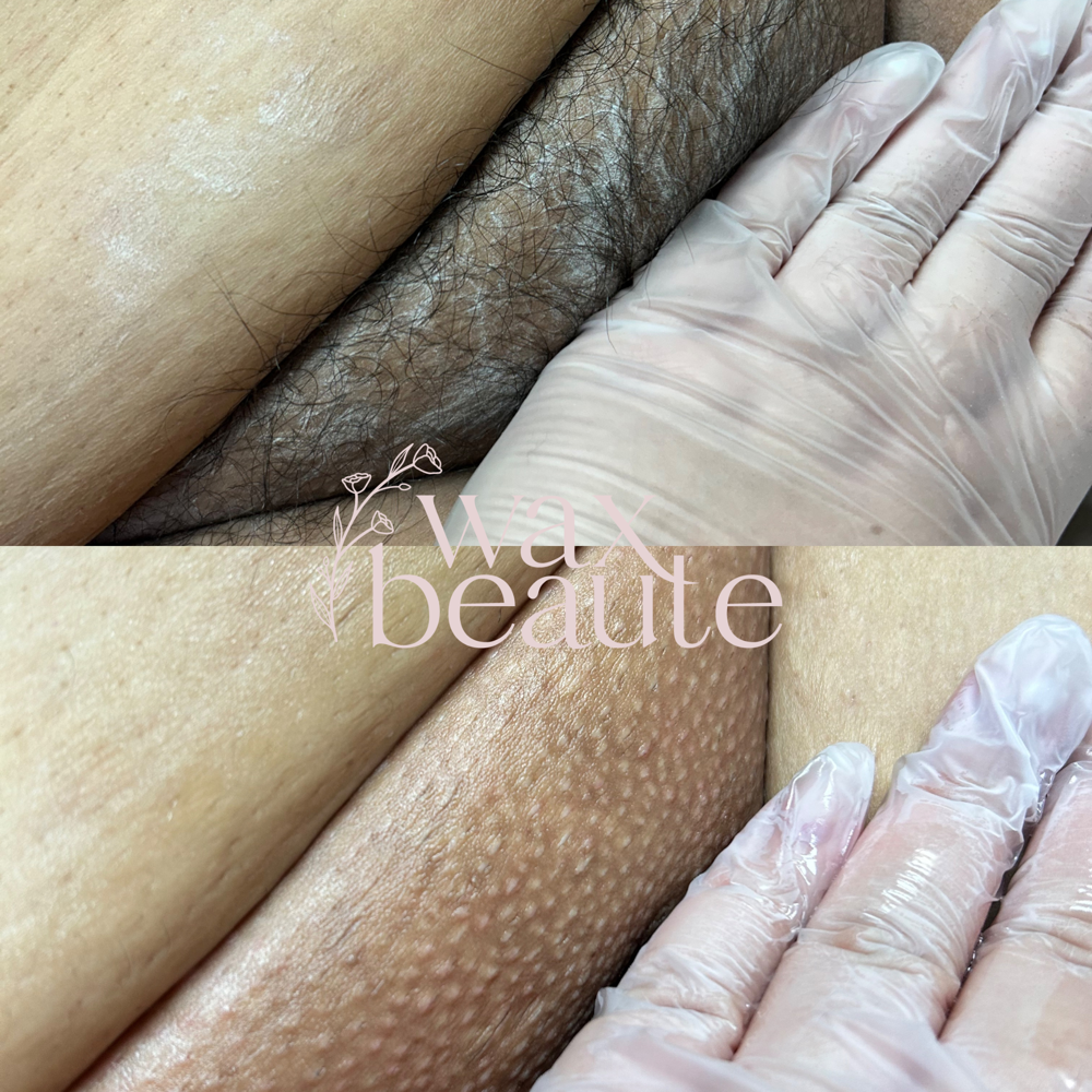 Women's Brazilian Wax