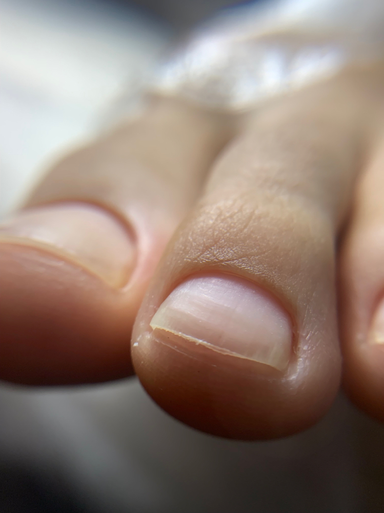 Hygienic Pedicure ( waterlees)
