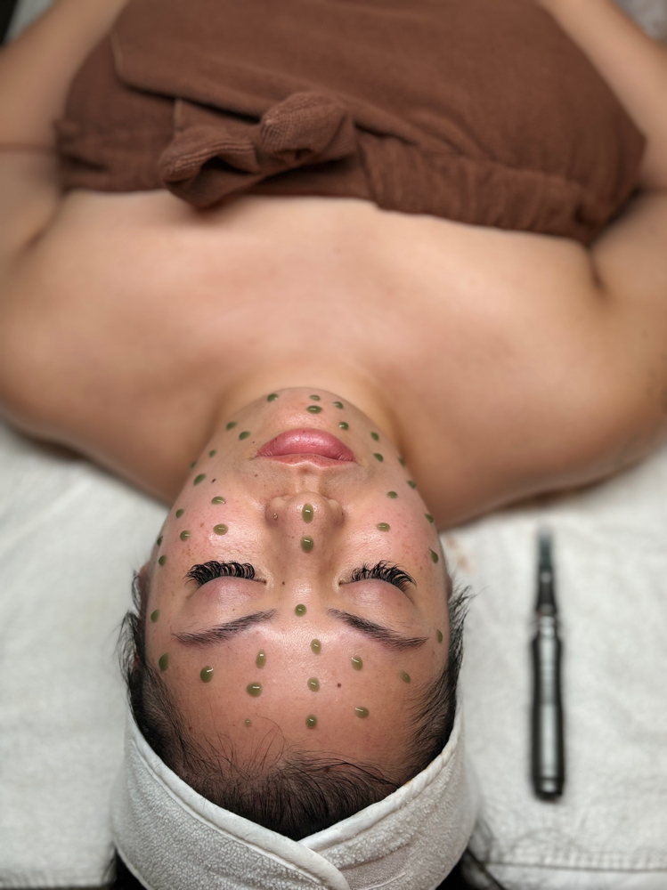 Inflacure Healing Facial