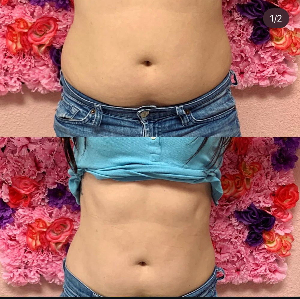 Body Sculpting 50 Min Session 1area at Linda’s Beauty Bar in Leander, TX