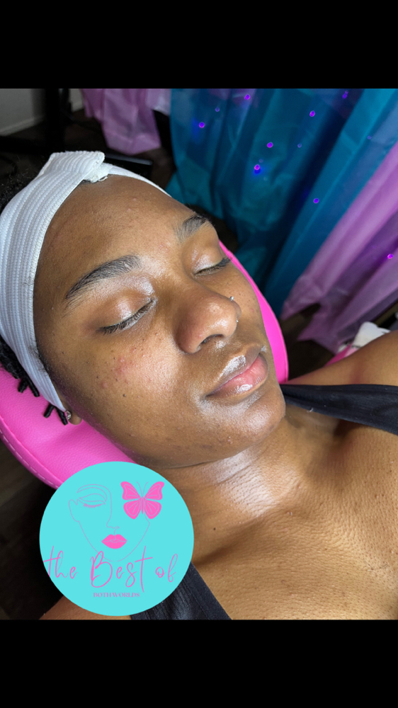 Dermaplaning Facial