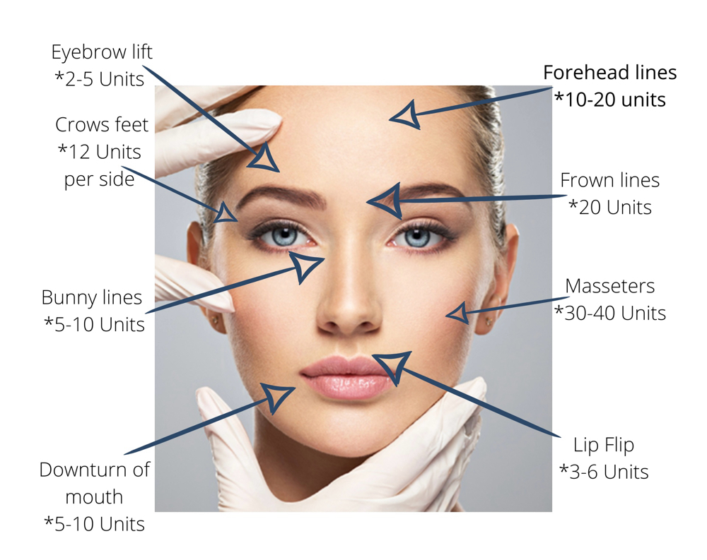 Botox, Daxify, Jeuveau
