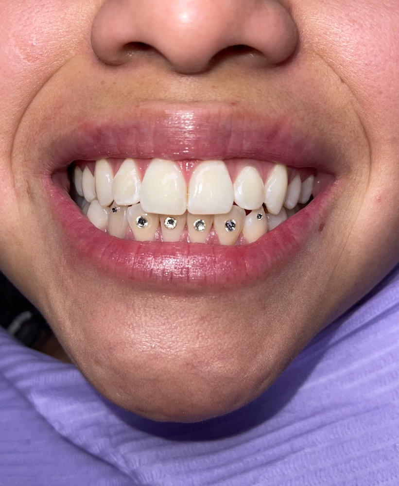 GRILL GRID™ [Reg $250]