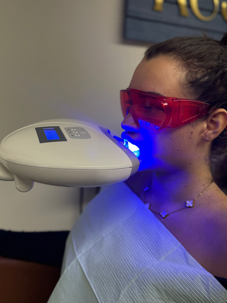 Teeth Whitening at RainbeautybyHeather in BEAVERCREEK, OH