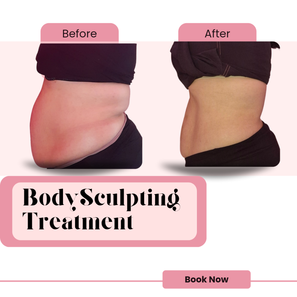 Ultrasonic Cavitation