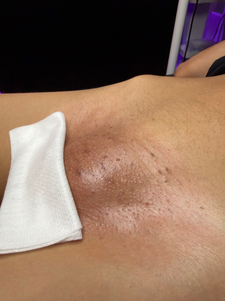 Bright & Bear Vagacial