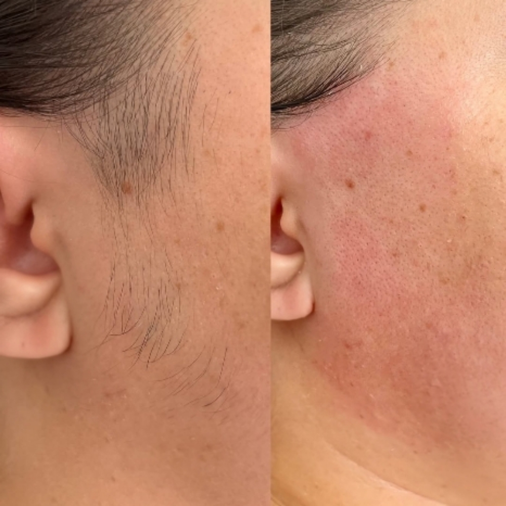 Sideburn Wax at Beautiful Creations Studio in Colorado Springs, CO