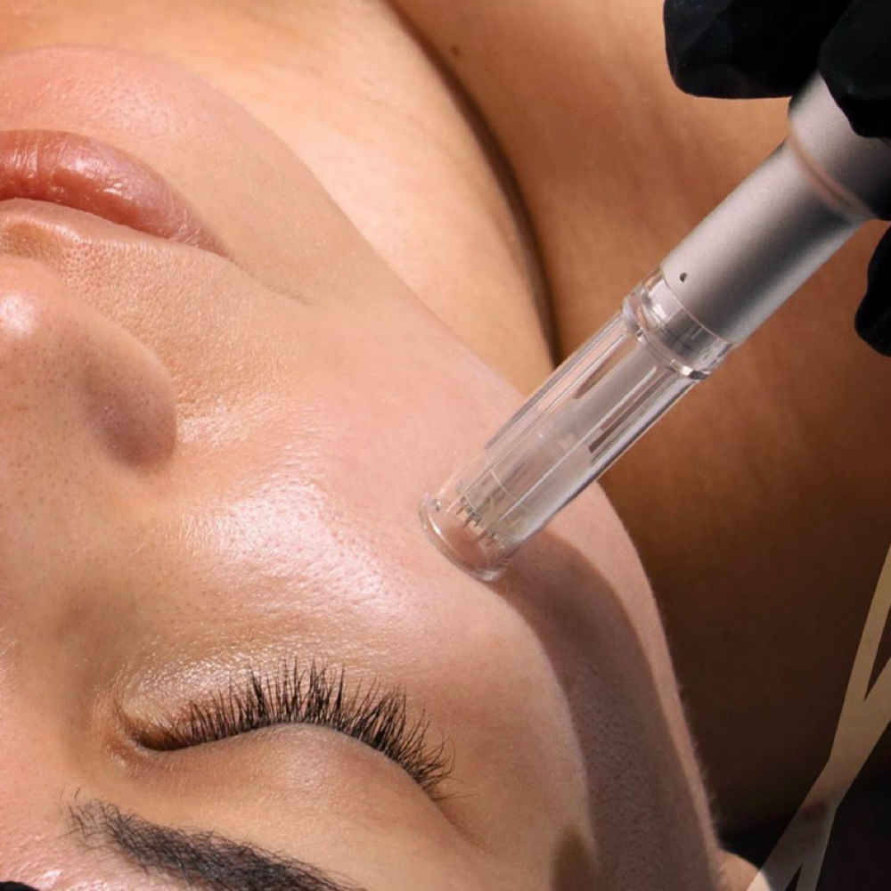 Nano-Needling Facial