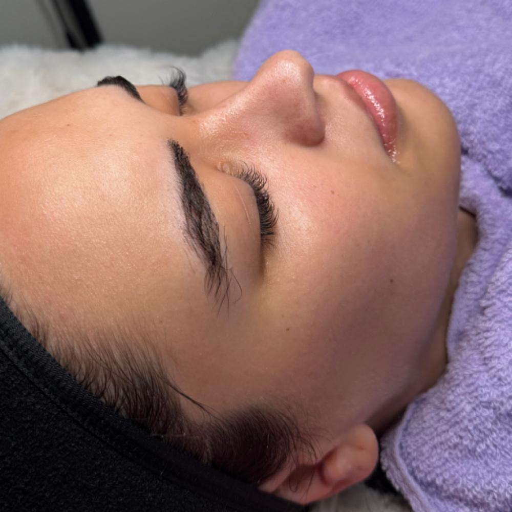Derma Planing at Beauty by Kendal in Prattville, AL