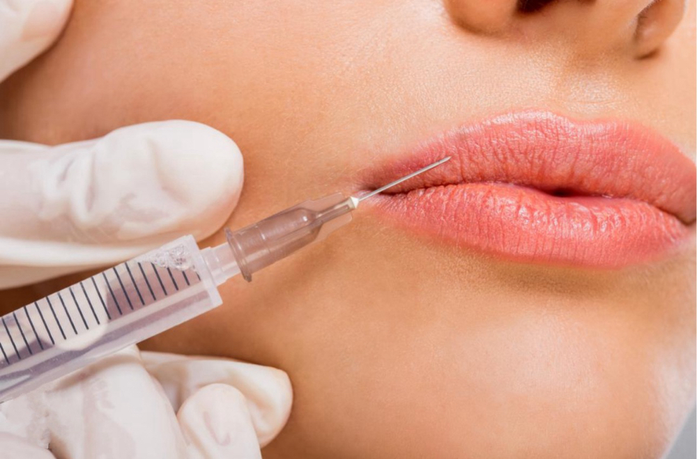 Dermal Filler