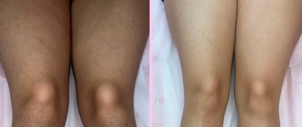 Upper Legs Wax (Thighs)