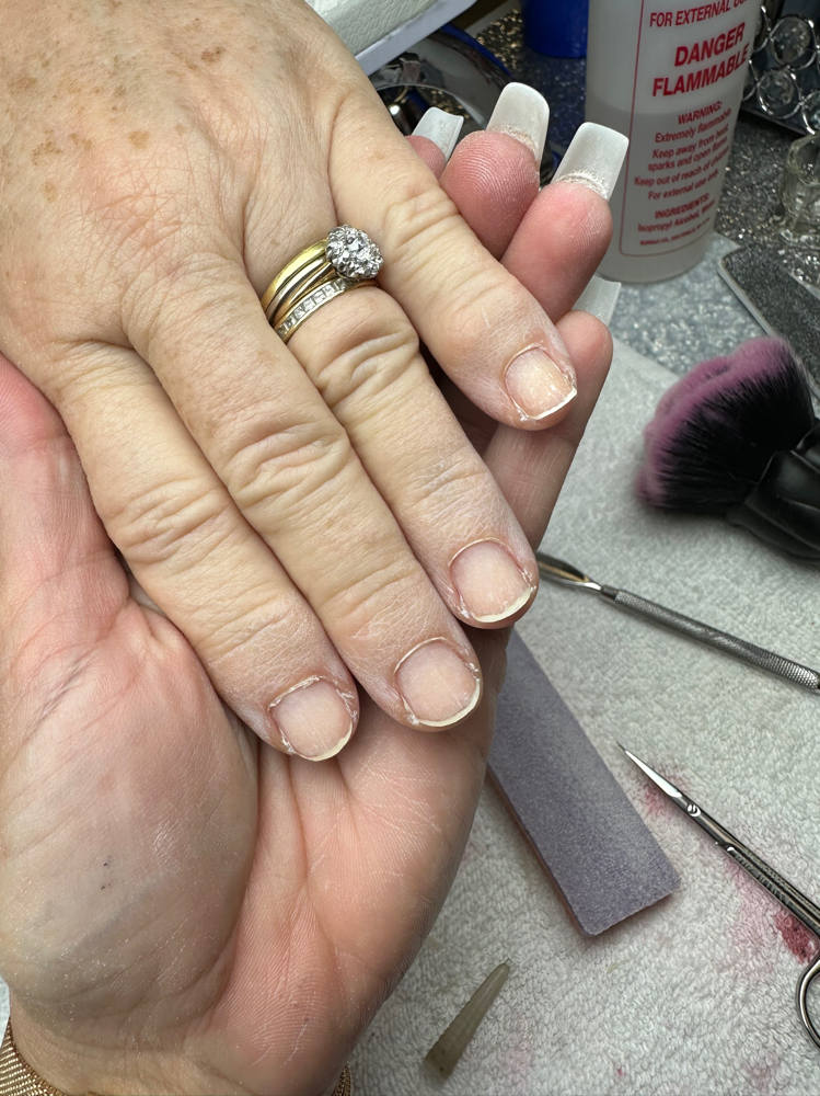 Removal Of Acrylic Nails