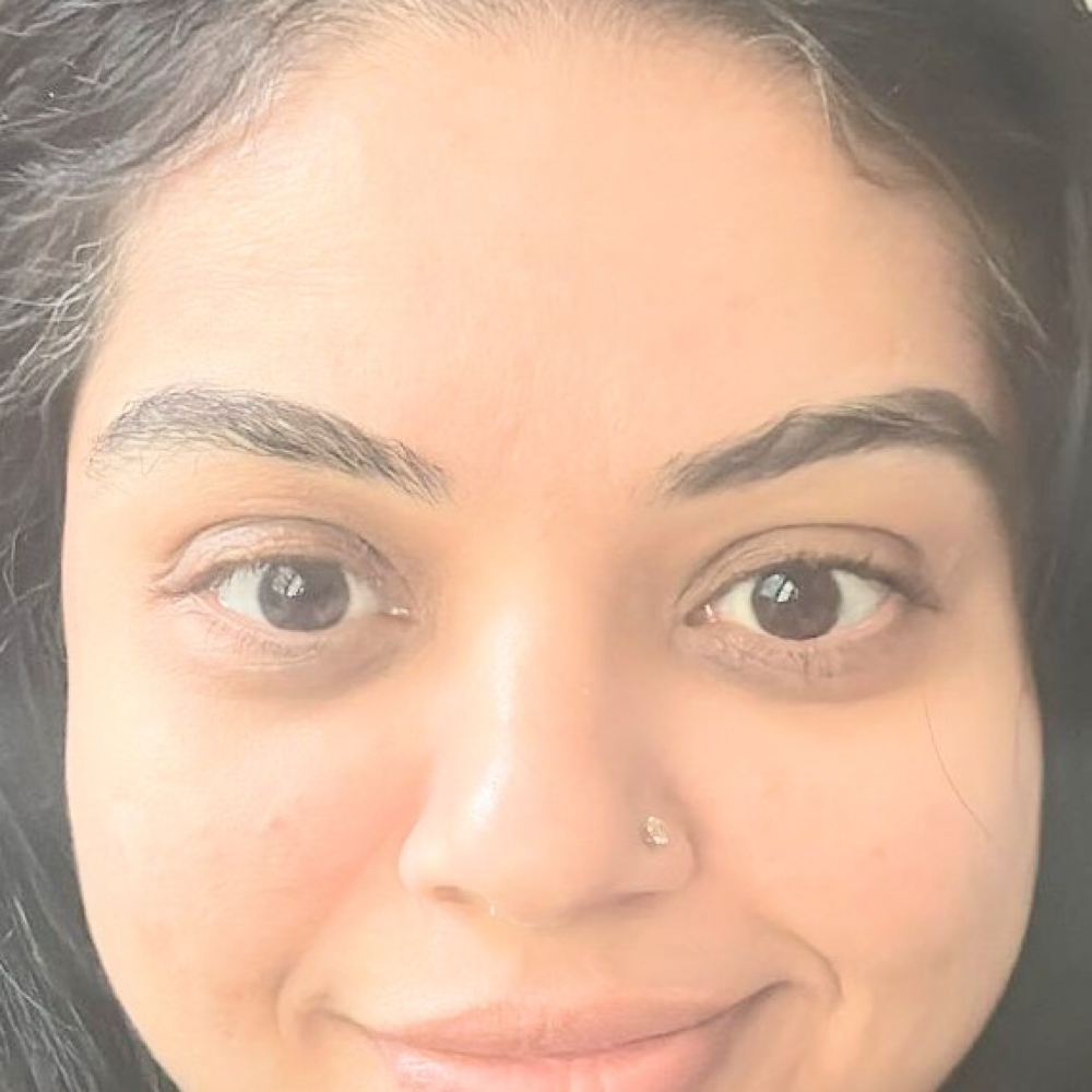 Micro Needling Treatment at Beautiess Esthetic in Concord, NC