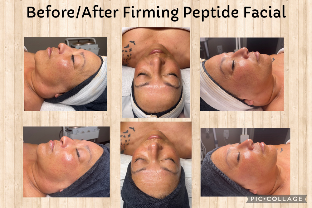 Firming Peptide Facial