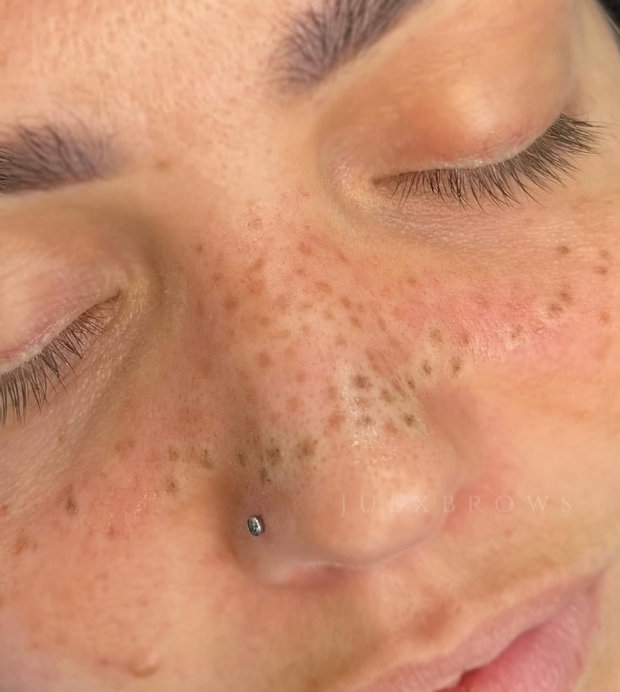 Permanent Freckles — Heavy Coverage