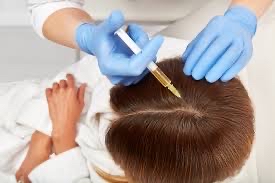 PRP-Scalp For Hair Rejuvination