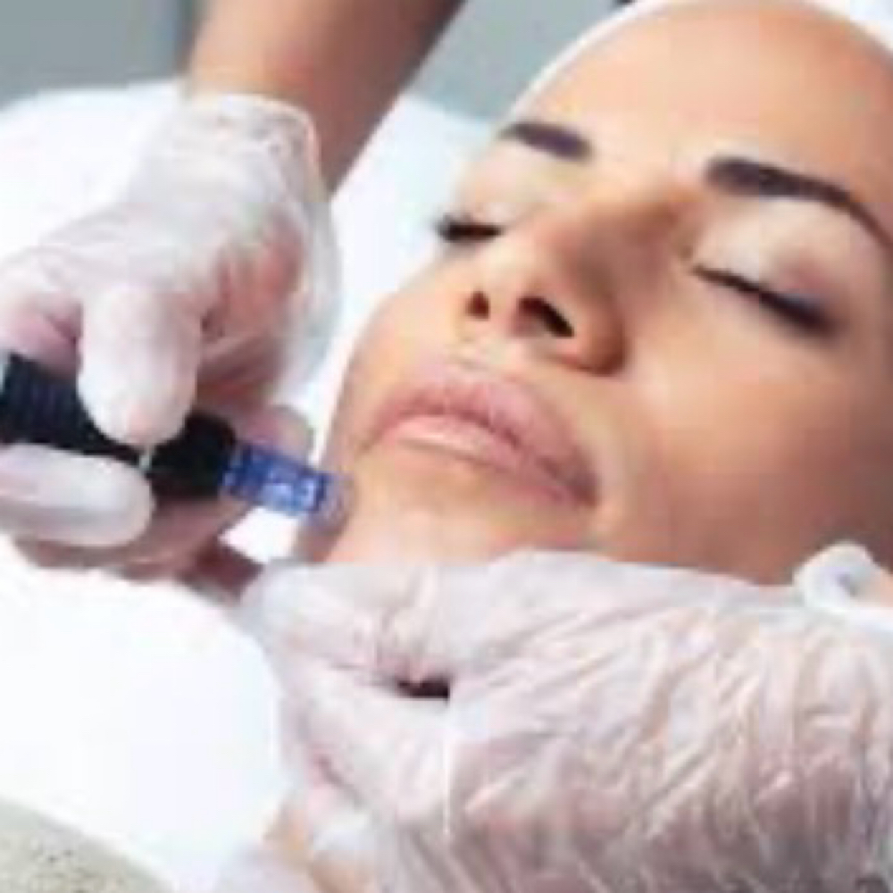 Microneedling at Antidote Mobile Studio