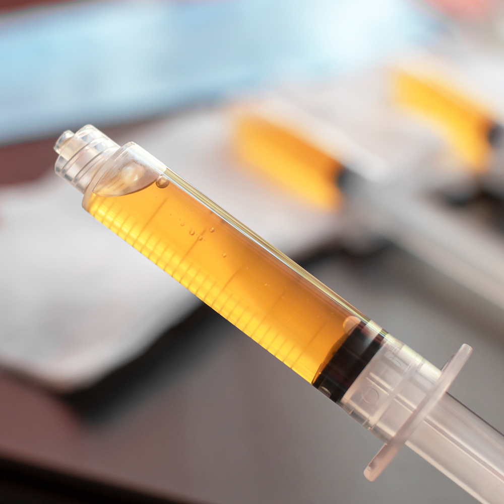 PRP Add-On at Beauty By Angel in Lebanon, KY