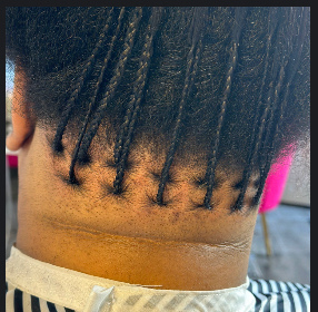 Tree Braids w/two Rows Of Micros