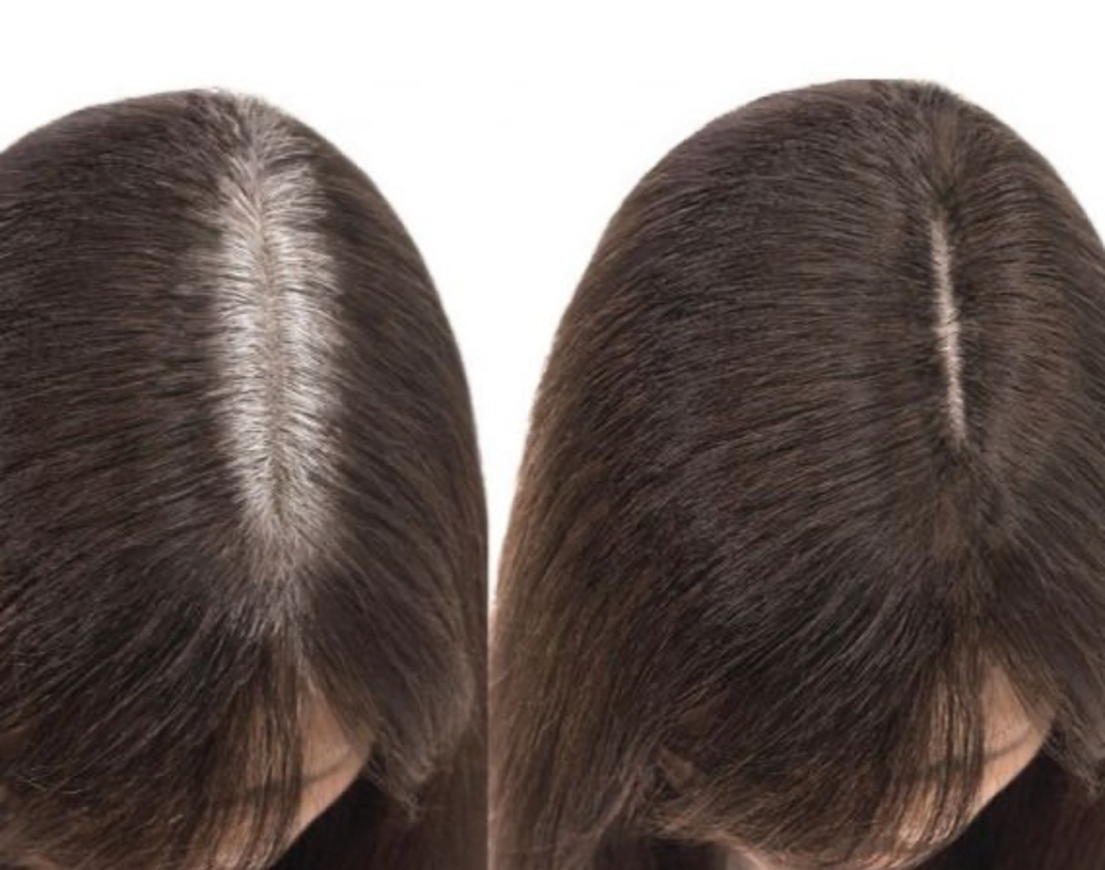 Gray hair growth retouching