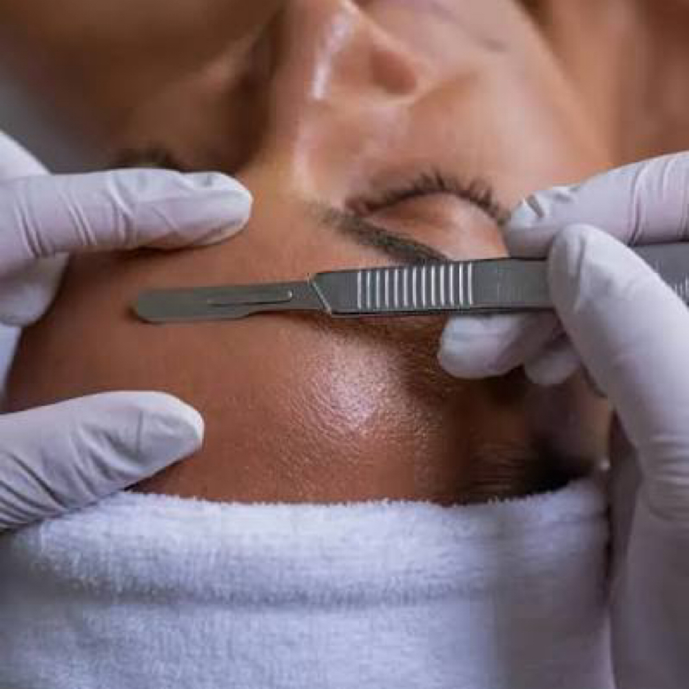 Dermaplaning at Sculpting Beauty by Pam LLC in Atascocita, TX