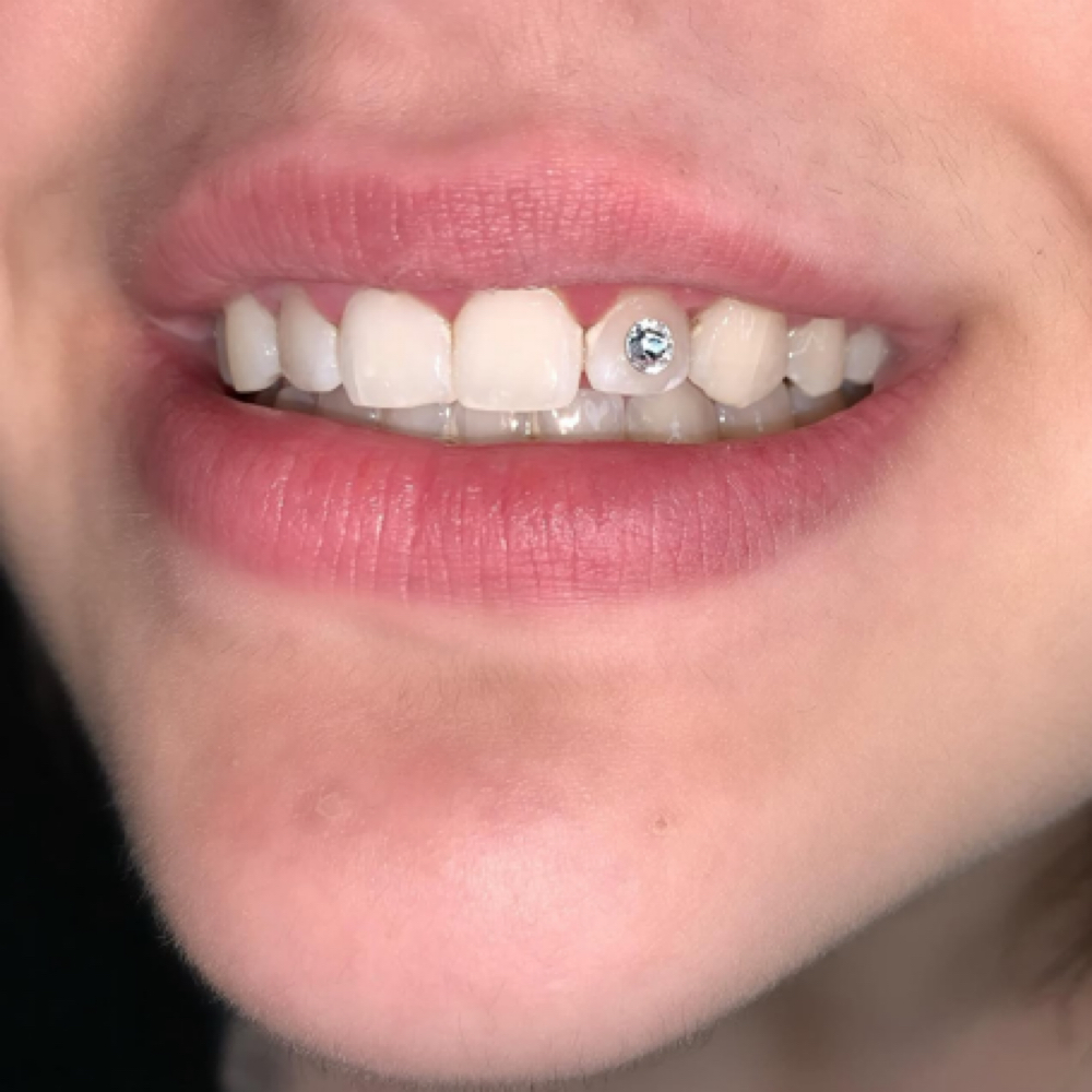 🧊I-CEE [LARGE]ᴺᴶ at MONMOUTH COUNTYᴺᴶ ✧ 1ST TOOTH JEWELER ↯ #POPURWAXINCHERRY🫟 in Hazlet, NJ
