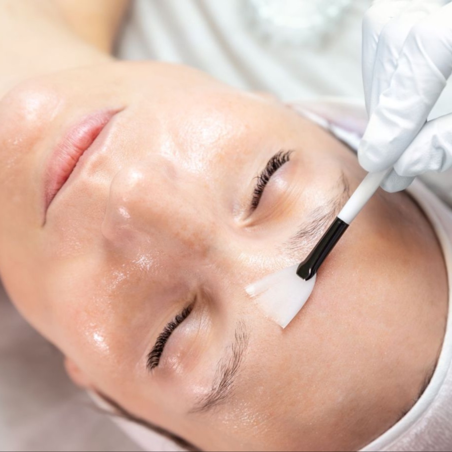 Facials Peels at Flavia Guimarães  Wellness & Beauty in Millbrae, CA