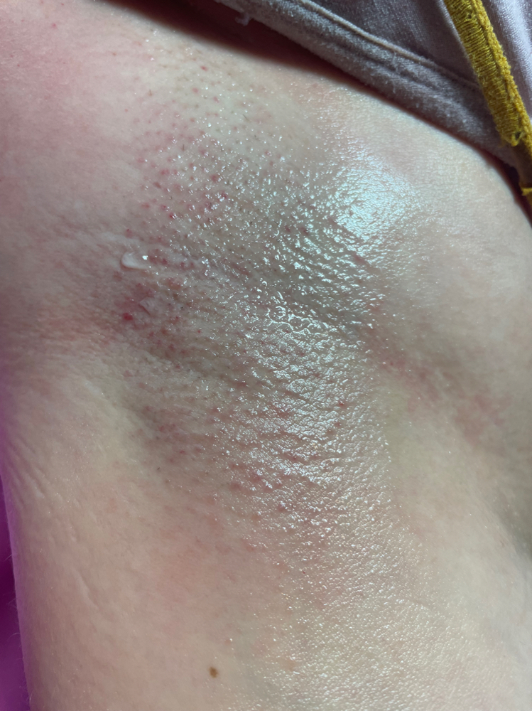 Underarm