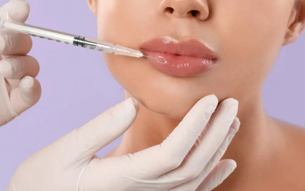 Lip Filler Dissolving