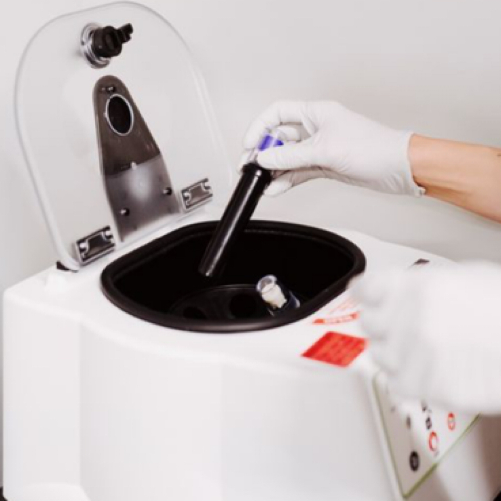 PRP Injections at AB Aesthetics II  PLLC in Clinton, MA