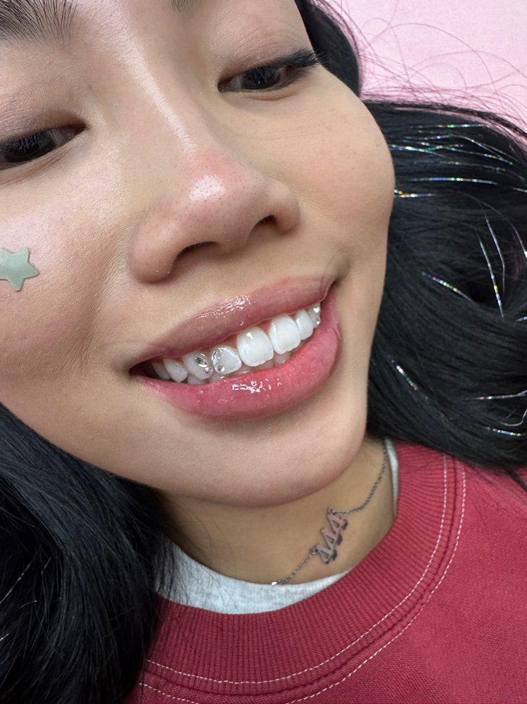 Teeth Gems at Peridot Studio in Lubbock, TX