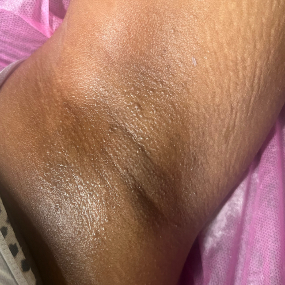 Underarm at Pretty Waxed Skin in Olive Branch, MS