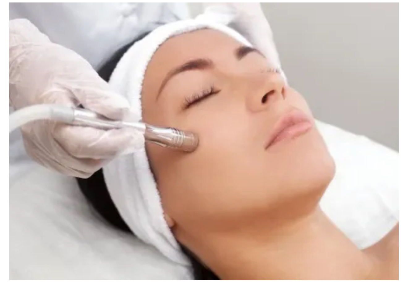 Microdermabrasion