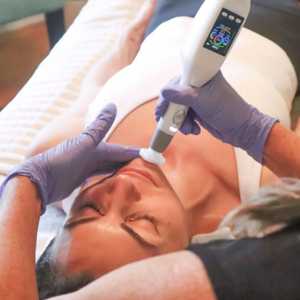 Jet Plasma Skin Treatment