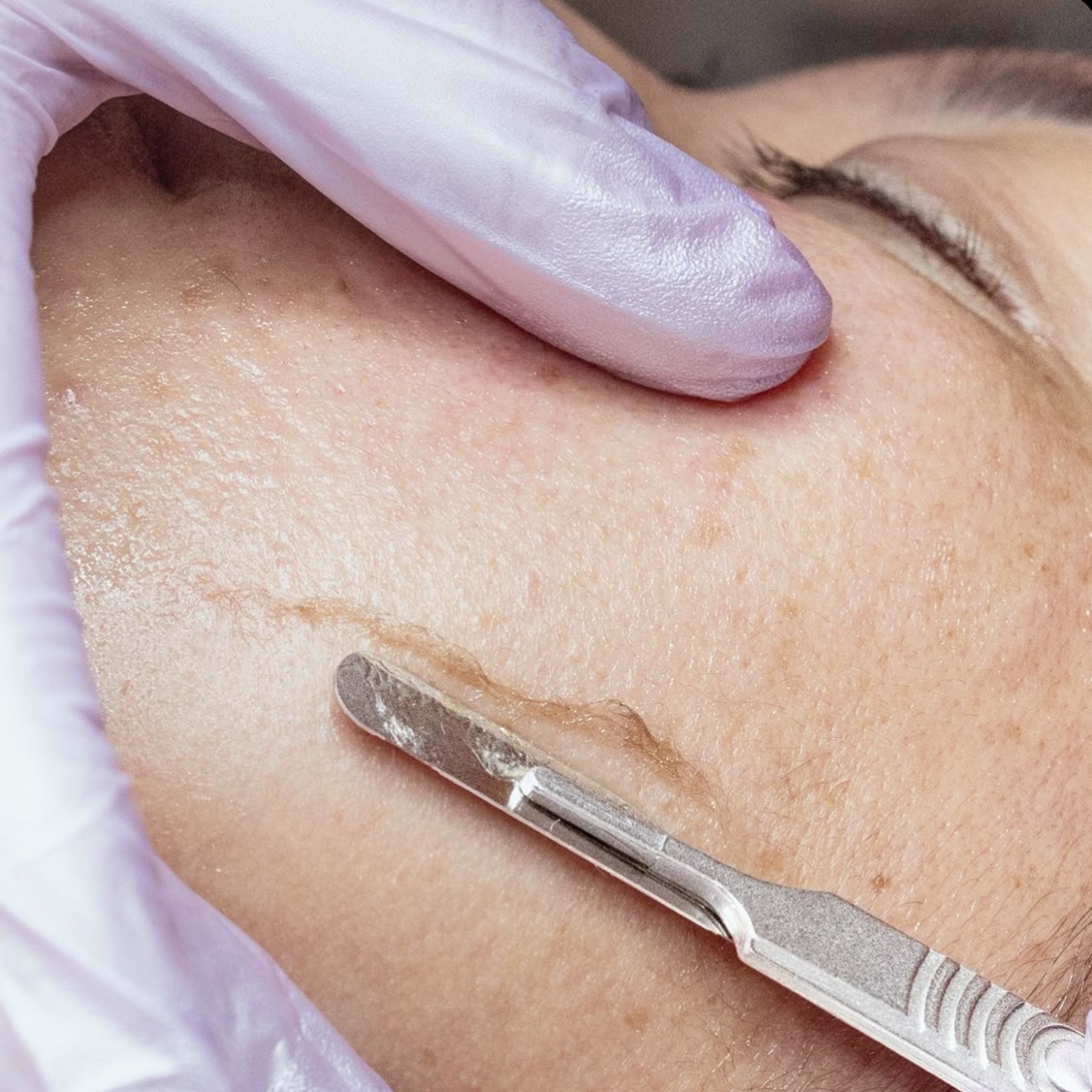 Glass Glow Dermaplane Facial at Glowbar in Prescott, AZ