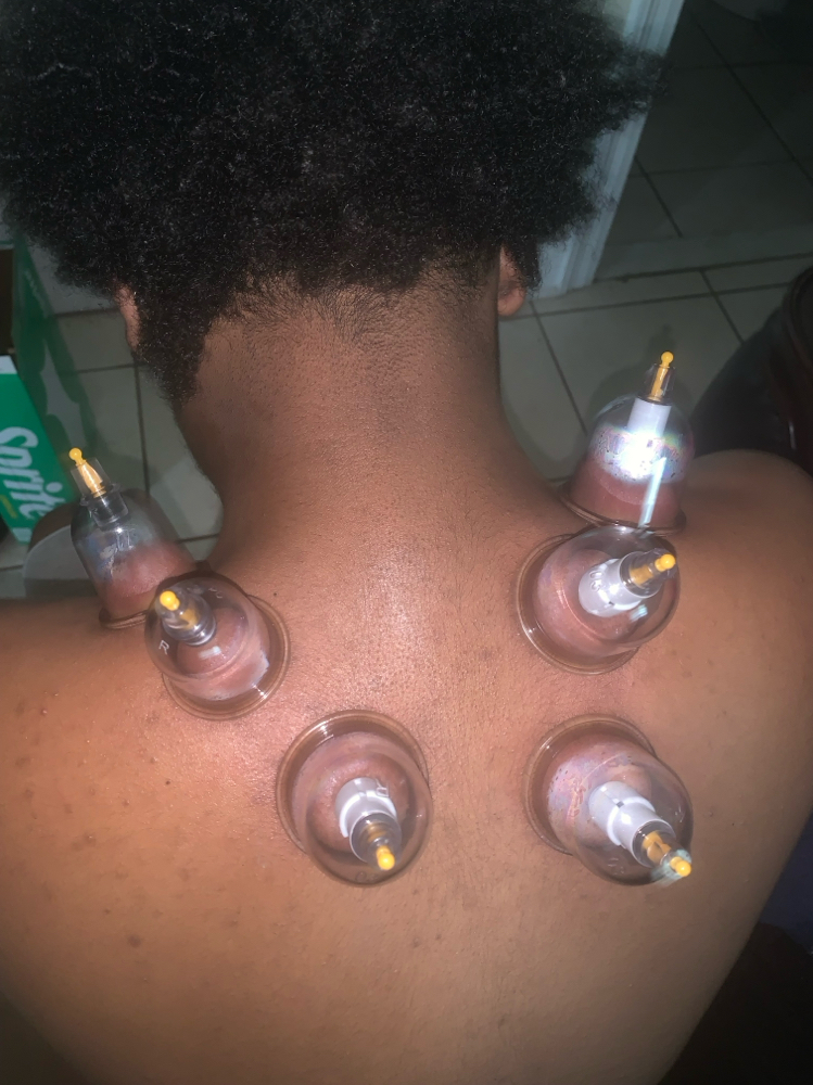 Full Body Stretch & Cupping Therapy