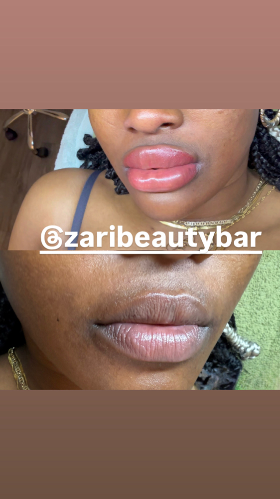 Lip Shading / Neutralization