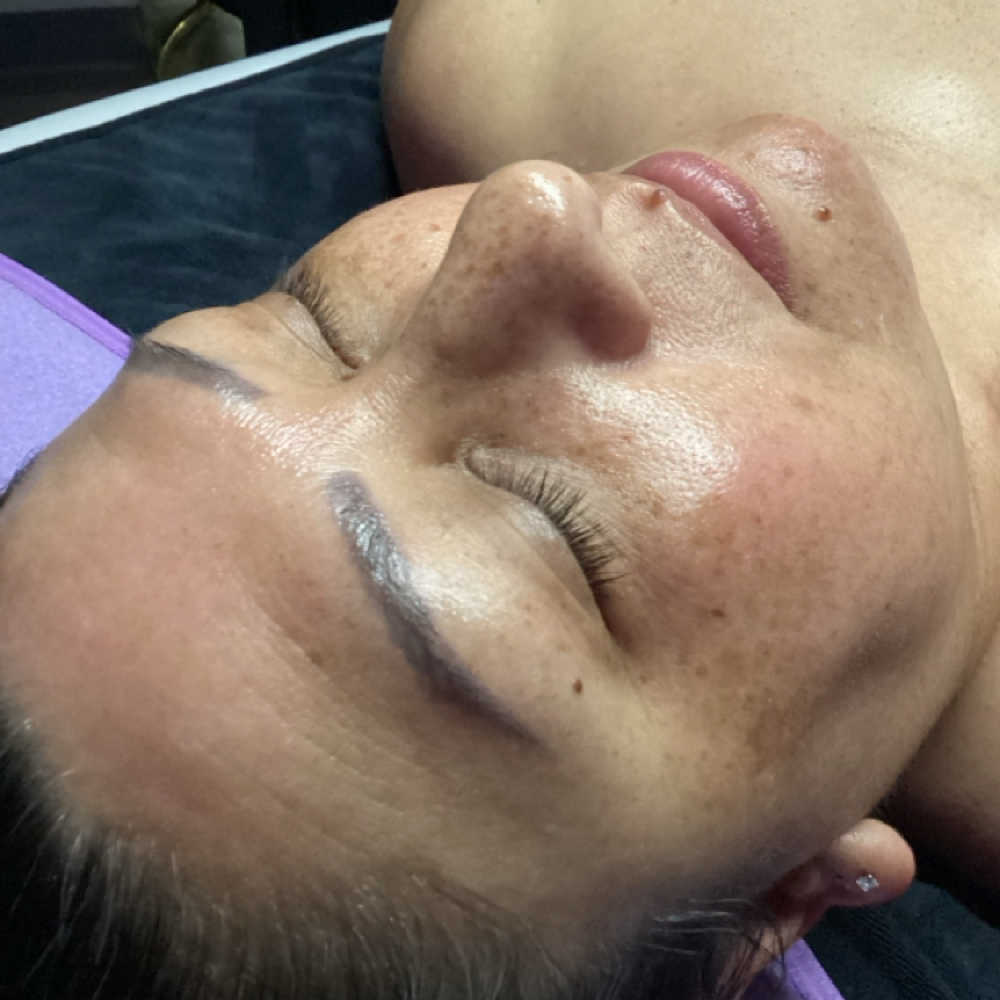 Coconut Honey Bloom Facial at Royal Luxe Aesthetics in Surprise, AZ