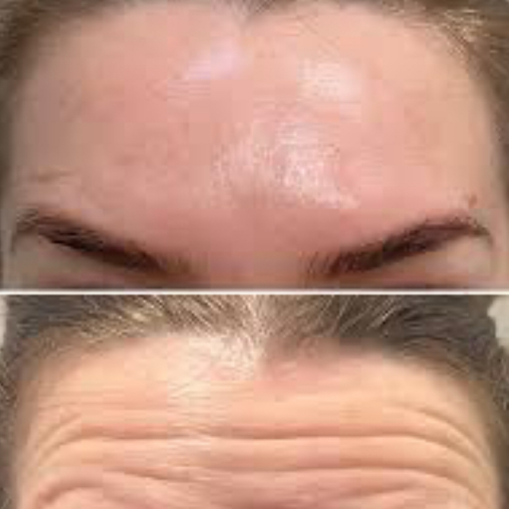 A’new Tox Per Unit