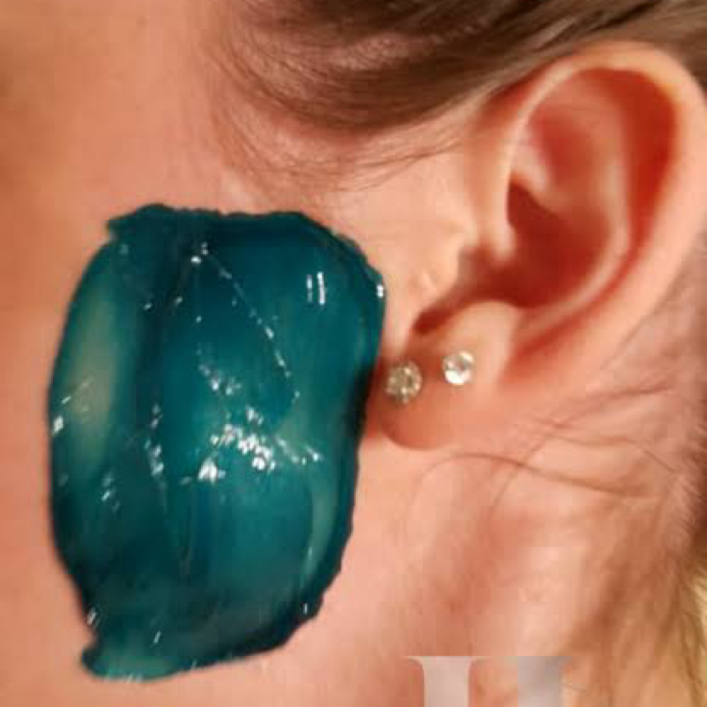 Side Burns at KB Esthetic Spa Inc. in Dalton, GA