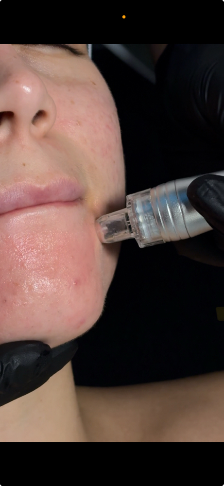 HydroDiamond Facial