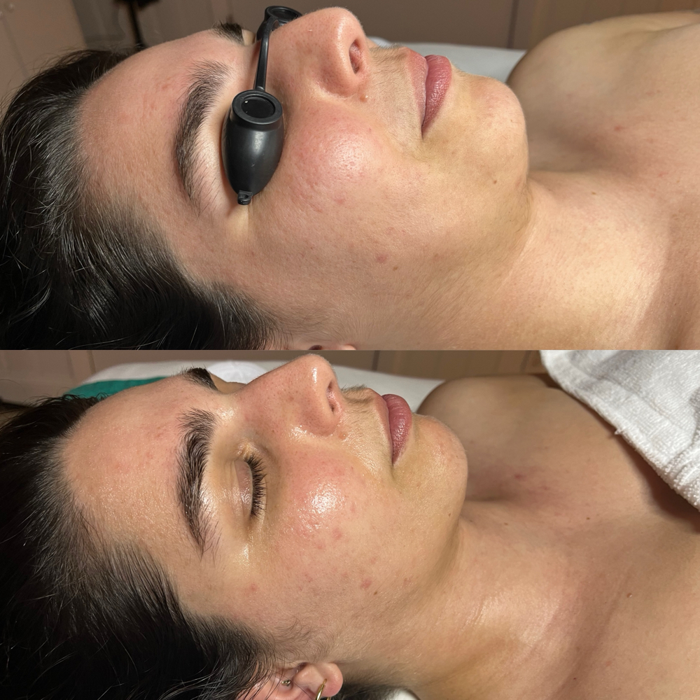 Glass Skin Gua Sha Facial