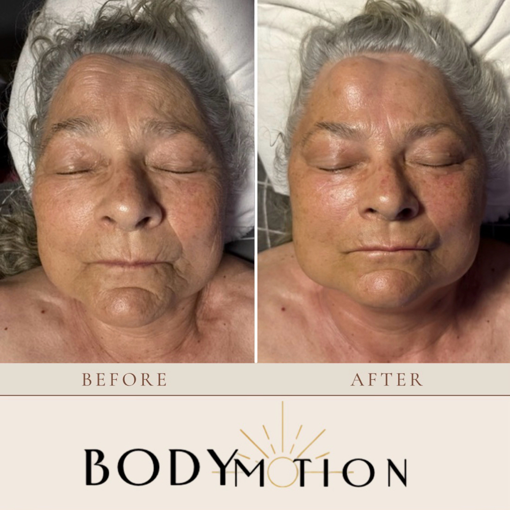 Hollistic Facial Repaterning at BodyMotions in Wellington, FL