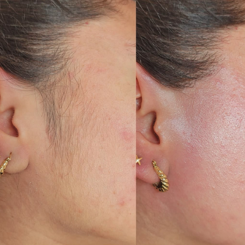 Side Burns at SKIN FIX in Colton, CA