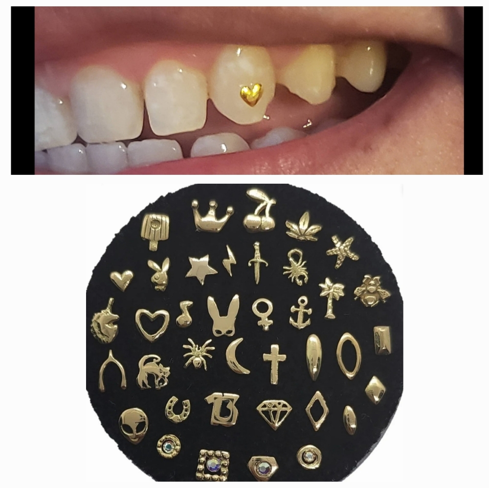 14 & 18k Gold Tooth Gems