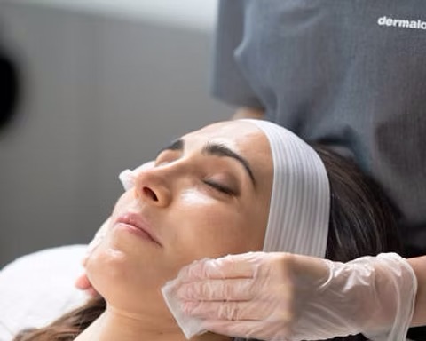 Immortal Glow Renewal Peel at IMMORTALIZED BEAUTY BY ANGIE in Riverbank, CA