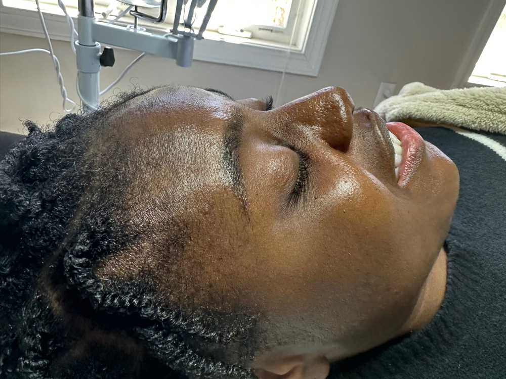 Hydration Facial