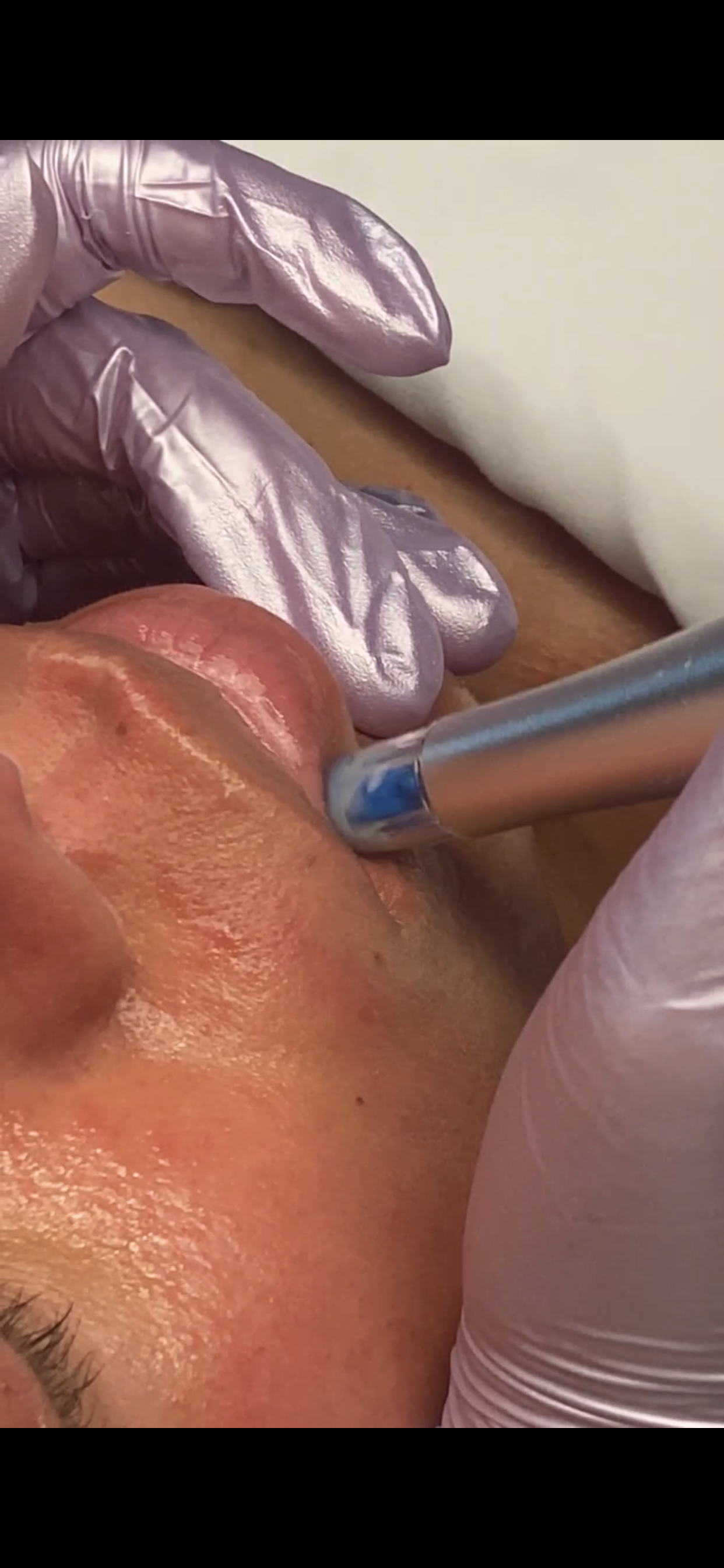 Nano-Infusion