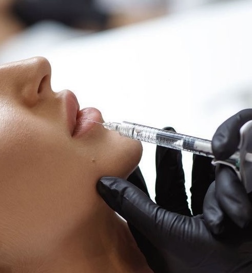 Lip Filler Dissolver